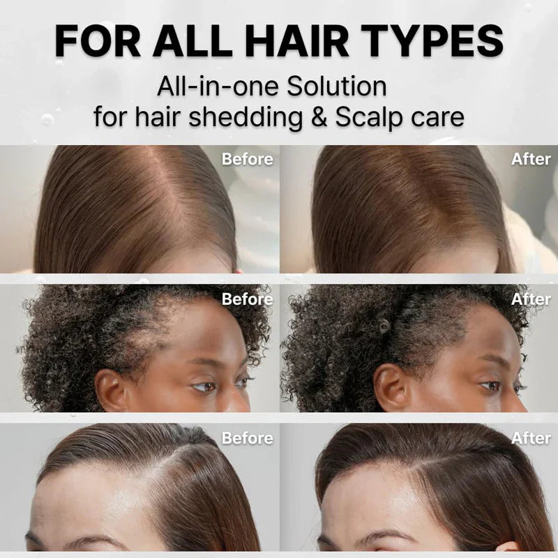 38-Bristle Hair Growth Scalp Serum