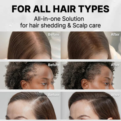 38-Bristle Hair Growth Scalp Serum