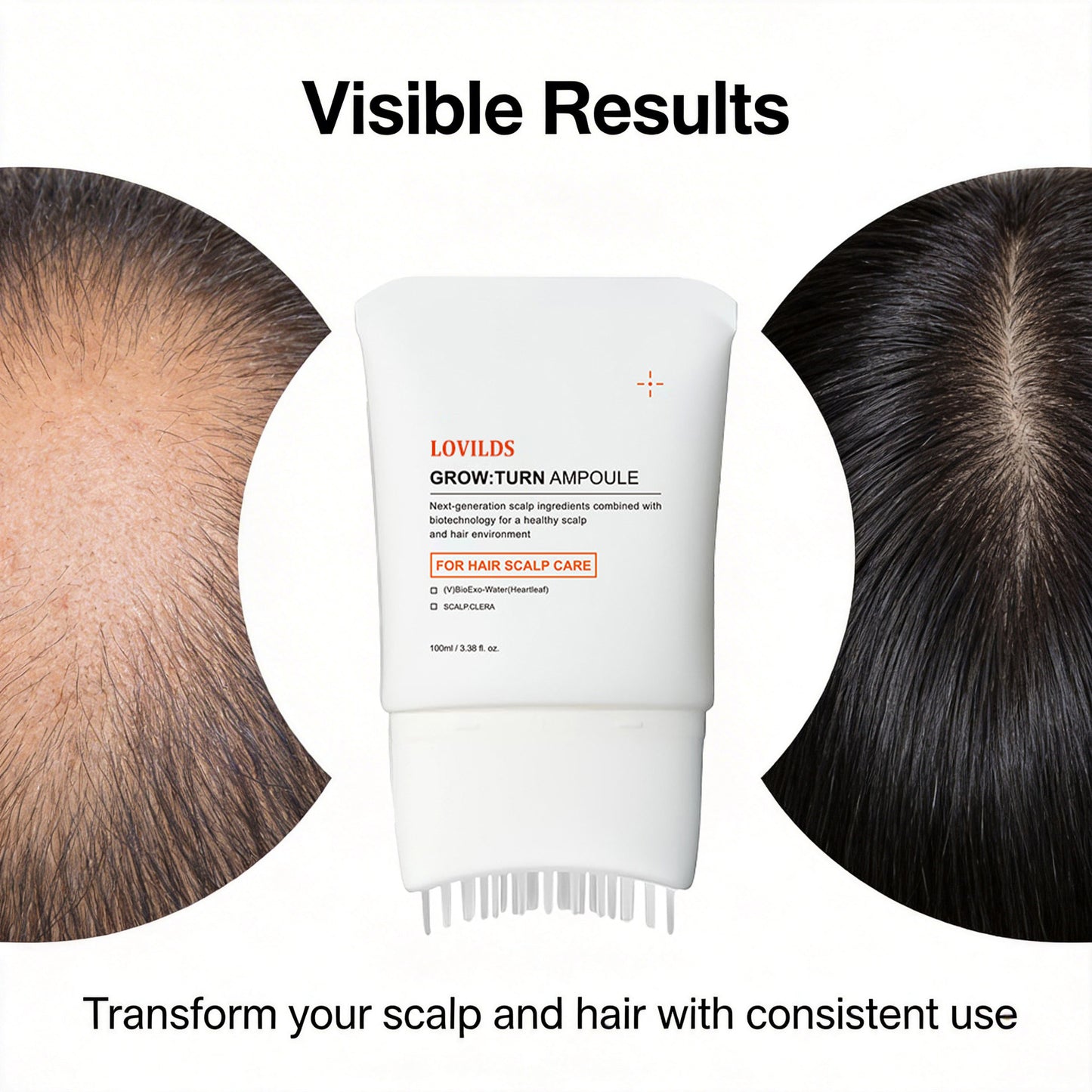 38-Bristle Hair Growth Scalp Serum